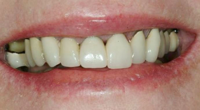 Dr. James Slaman's patient before reconstruction