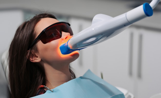 Professional teeth whitening