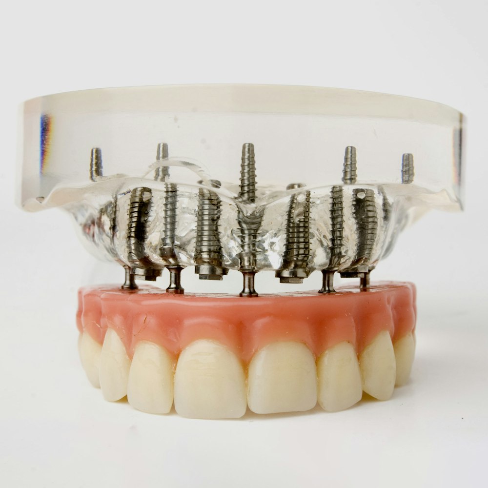 Implant-Supported Dentures