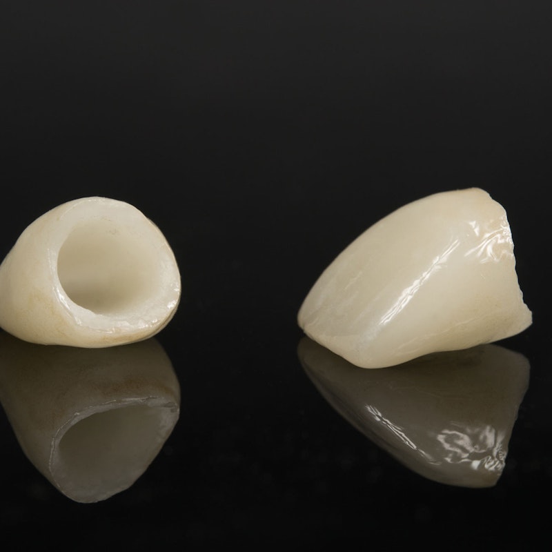 Dental crowns
